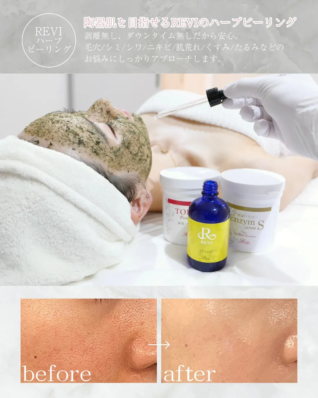 【メニュー紹介🌿REVIハーブピーリング】