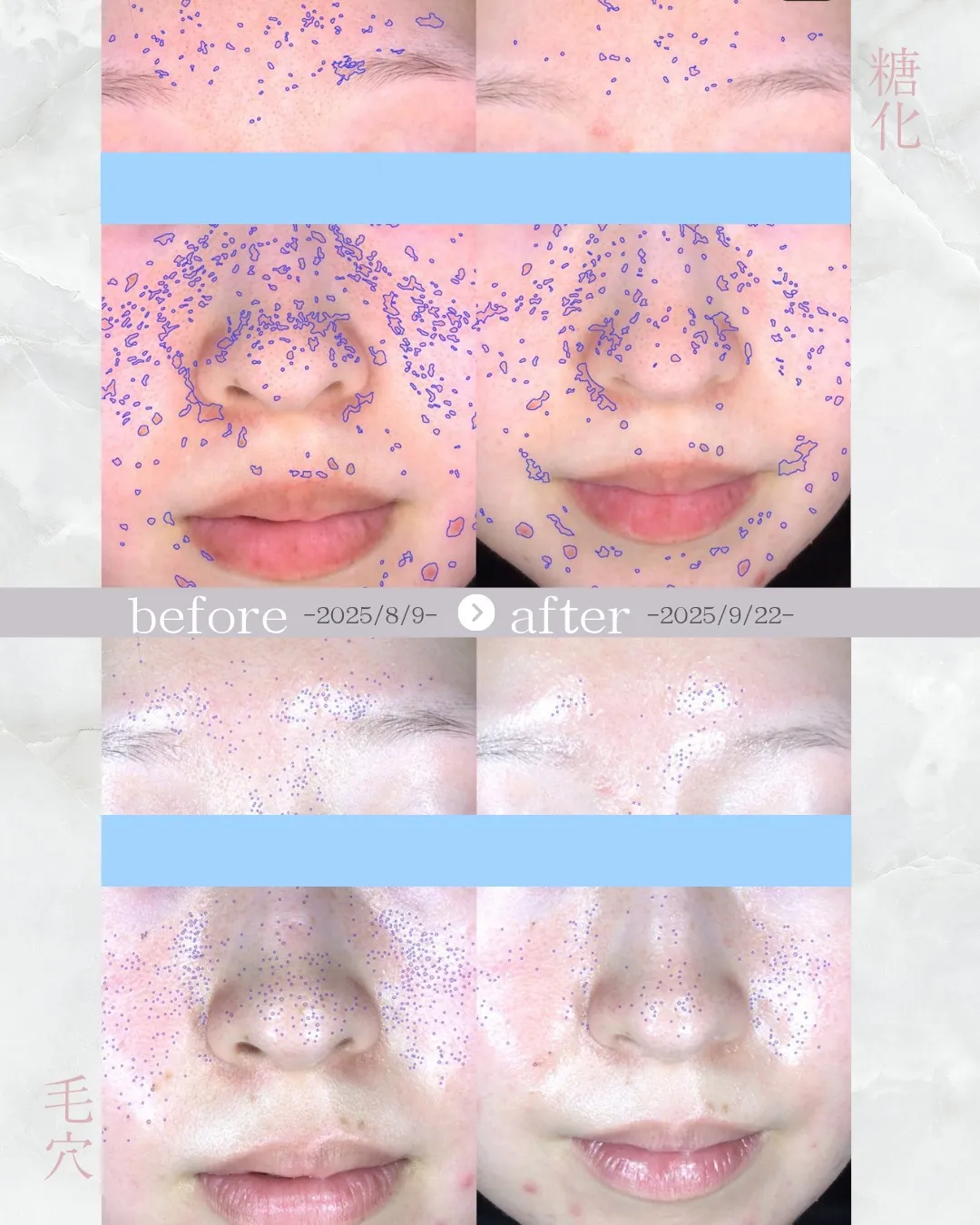 【メニュー紹介🌿人気No.1のオーダーメイド肌管理】