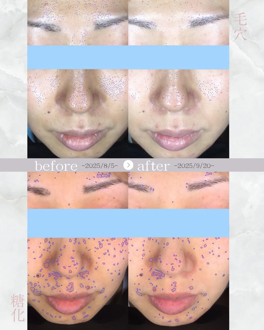 【メニュー紹介🌿人気No.1のオーダーメイド肌管理】