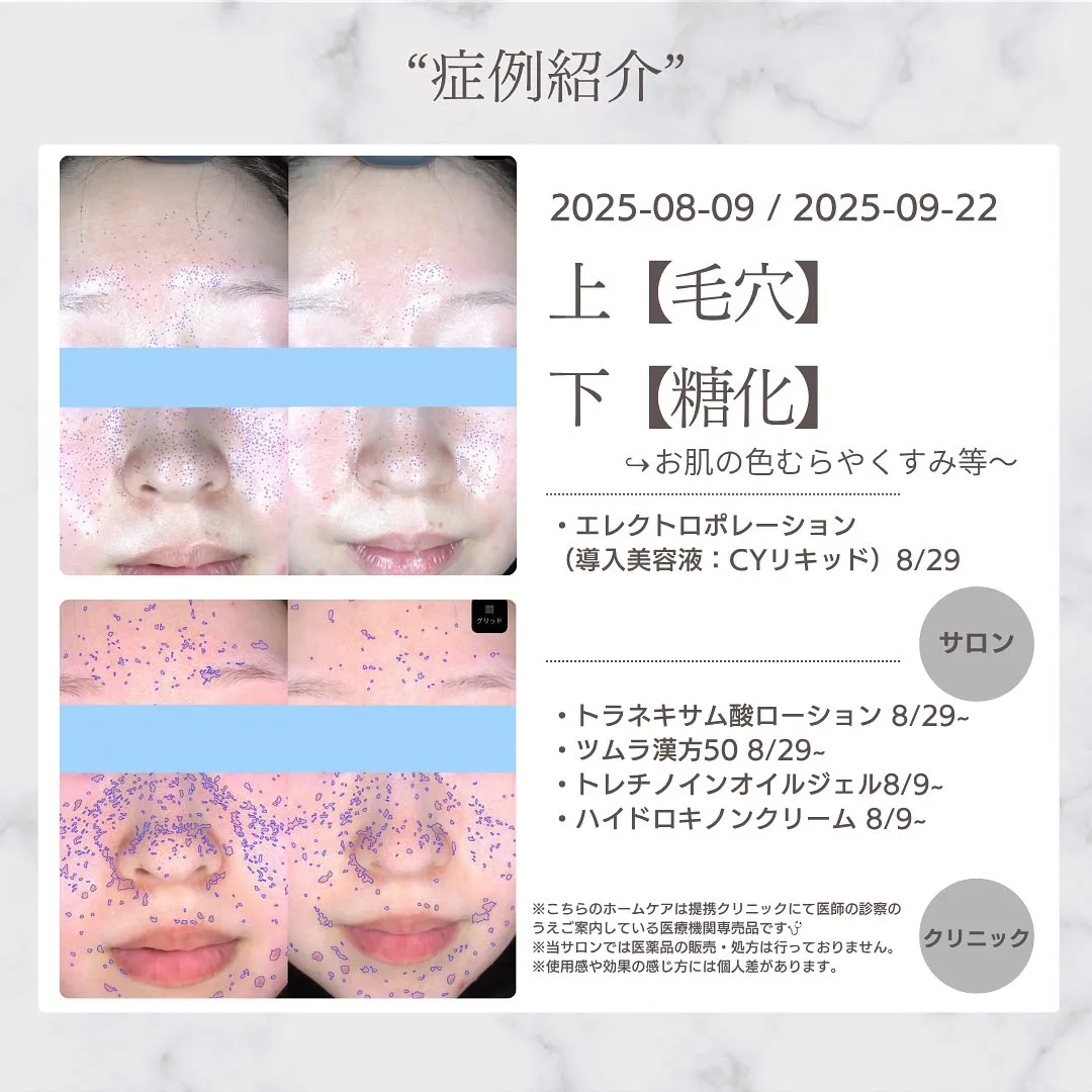 📣【モニター様募集のお知らせ】