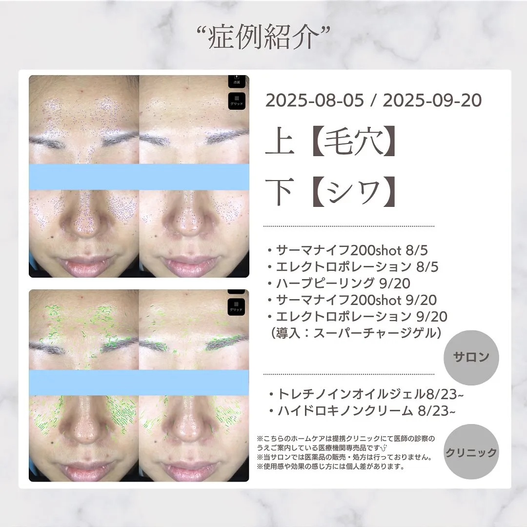 📣【モニター様募集のお知らせ】